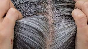 wellhealthorganic.com:know-the-causes-of-white-hair-and-easy-ways-to-prevent-it-naturally